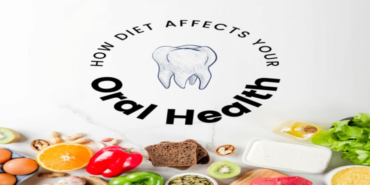 The Impact of Nutrition on Oral Health: Beyond Just Cavities